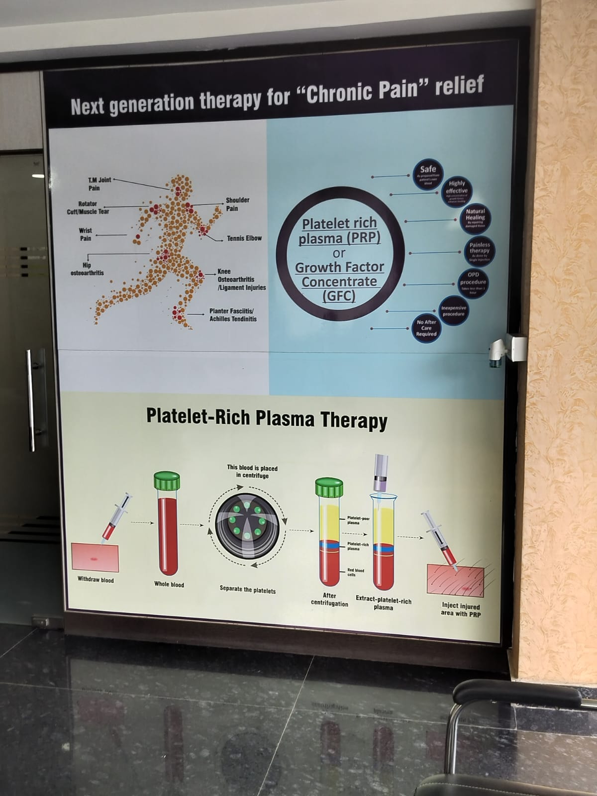 Treatment Area